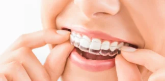 How to Clean Invisalign