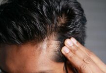 How to Prevent Hair Thinning Before It Starts