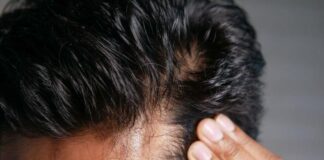 How to Prevent Hair Thinning Before It Starts