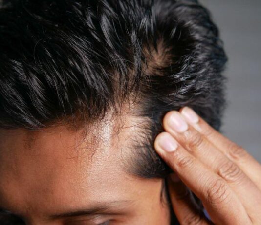 How to Prevent Hair Thinning Before It Starts