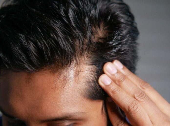 How to Prevent Hair Thinning Before It Starts